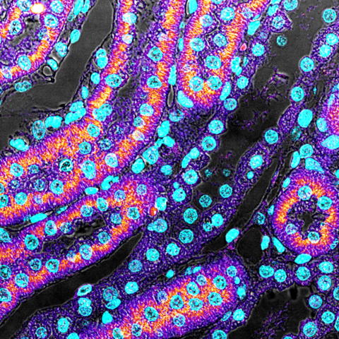 Rainbow renal tubules
