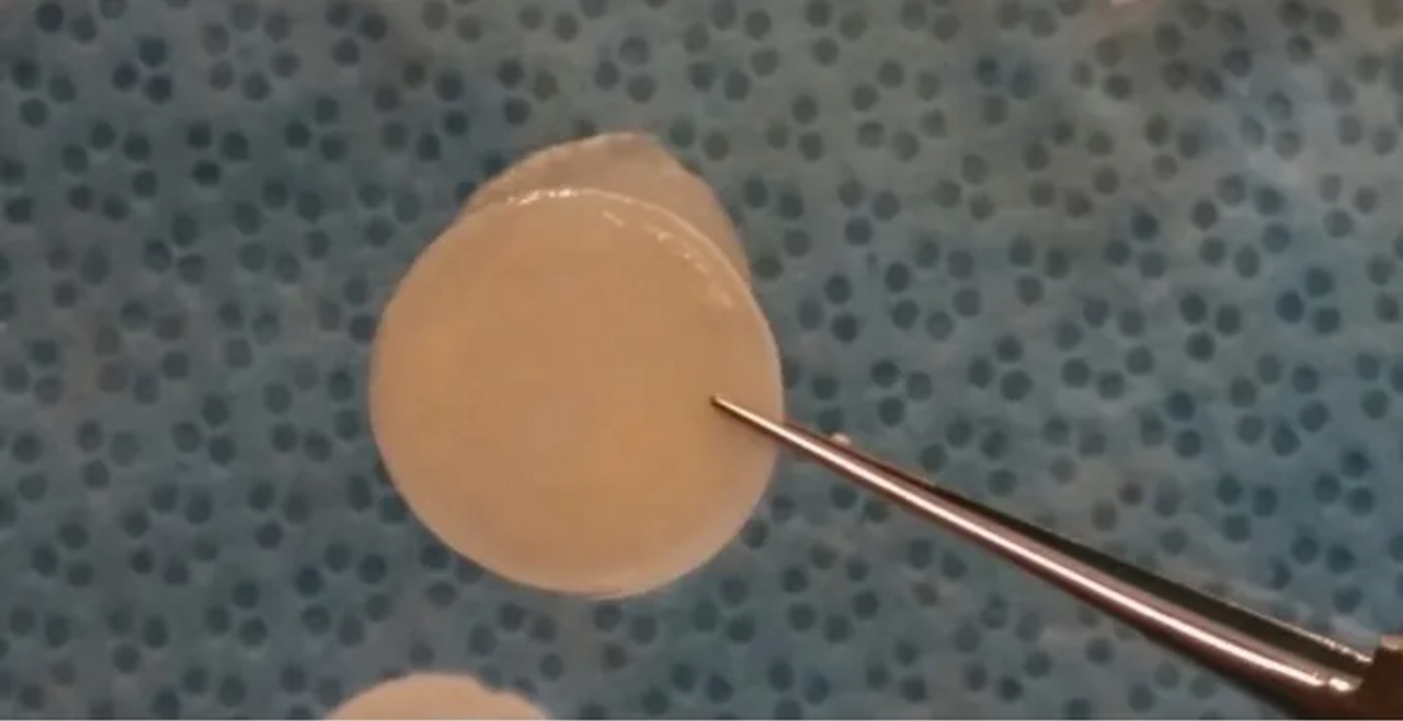 ElutiGlass PLGA wafer prior to insertion.