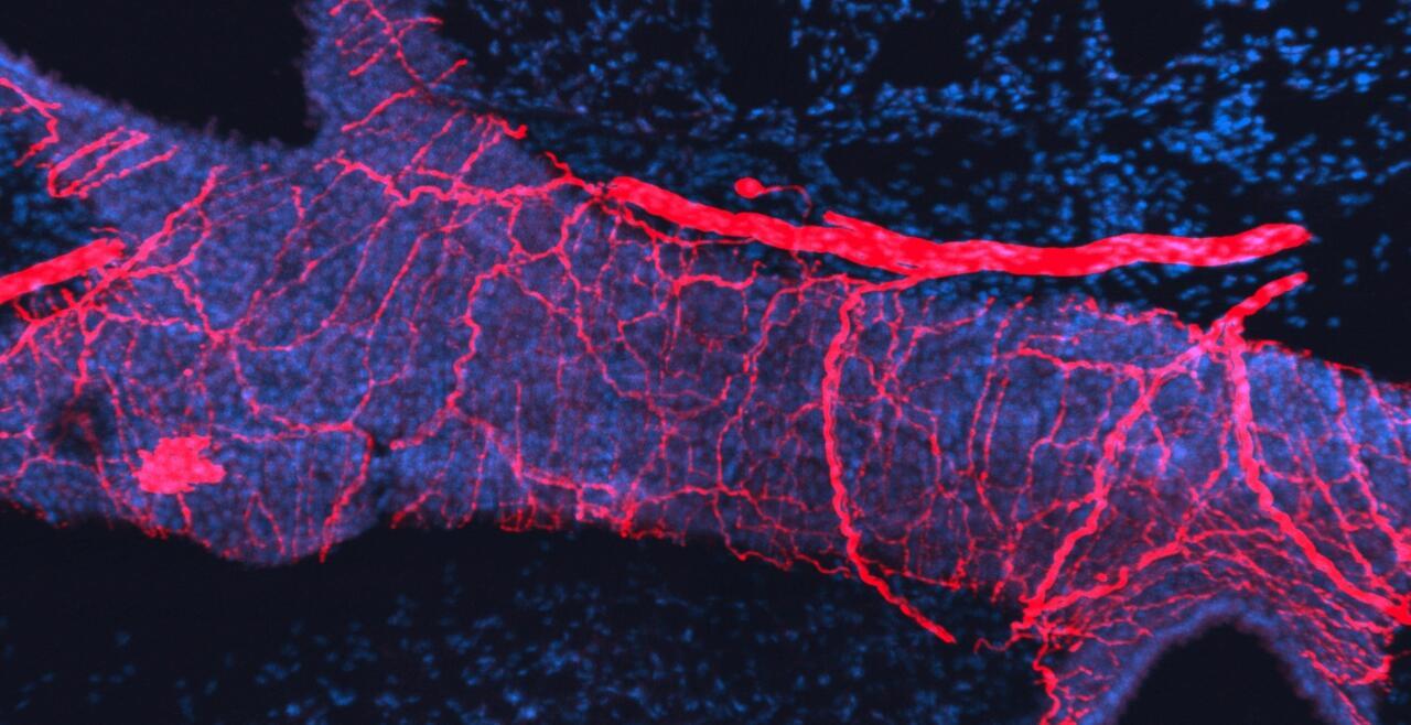 Dense innervation of a large bronchiole (blue) in the lung by nodose sensory nerves (red)