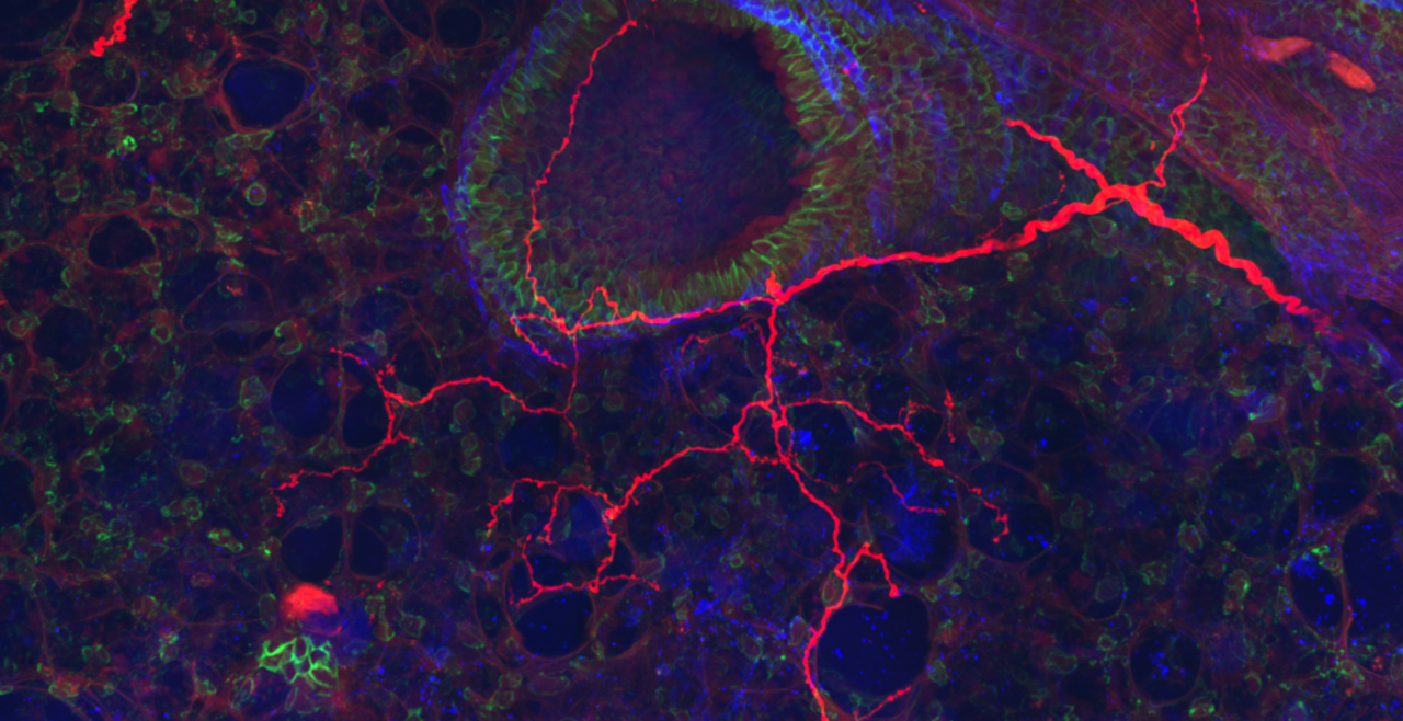 Fiber projected from nodose ganglion (red) innervating a small bronchiole and neighboring alveoli in the lung
