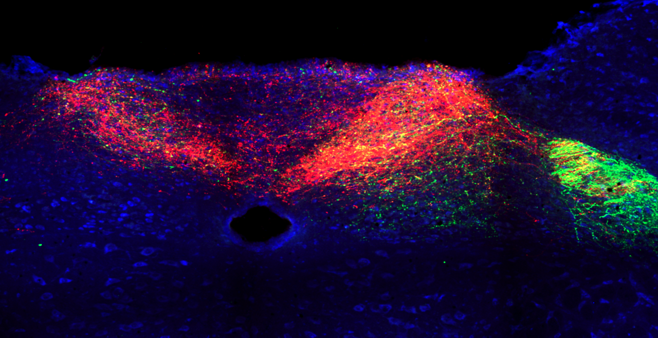 Central projections of vagal TRPV1+ (red) and TRPV1- (green) fibers to the nucleus tractus solitarius