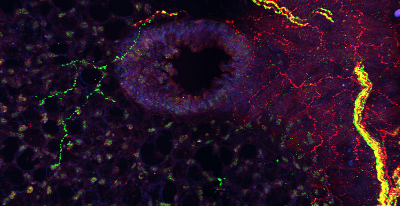 Selective innervation of large and small bronchioles and alveoli by nodose TRPV1+ (green) and jugular TRPV1+ (red) fibers