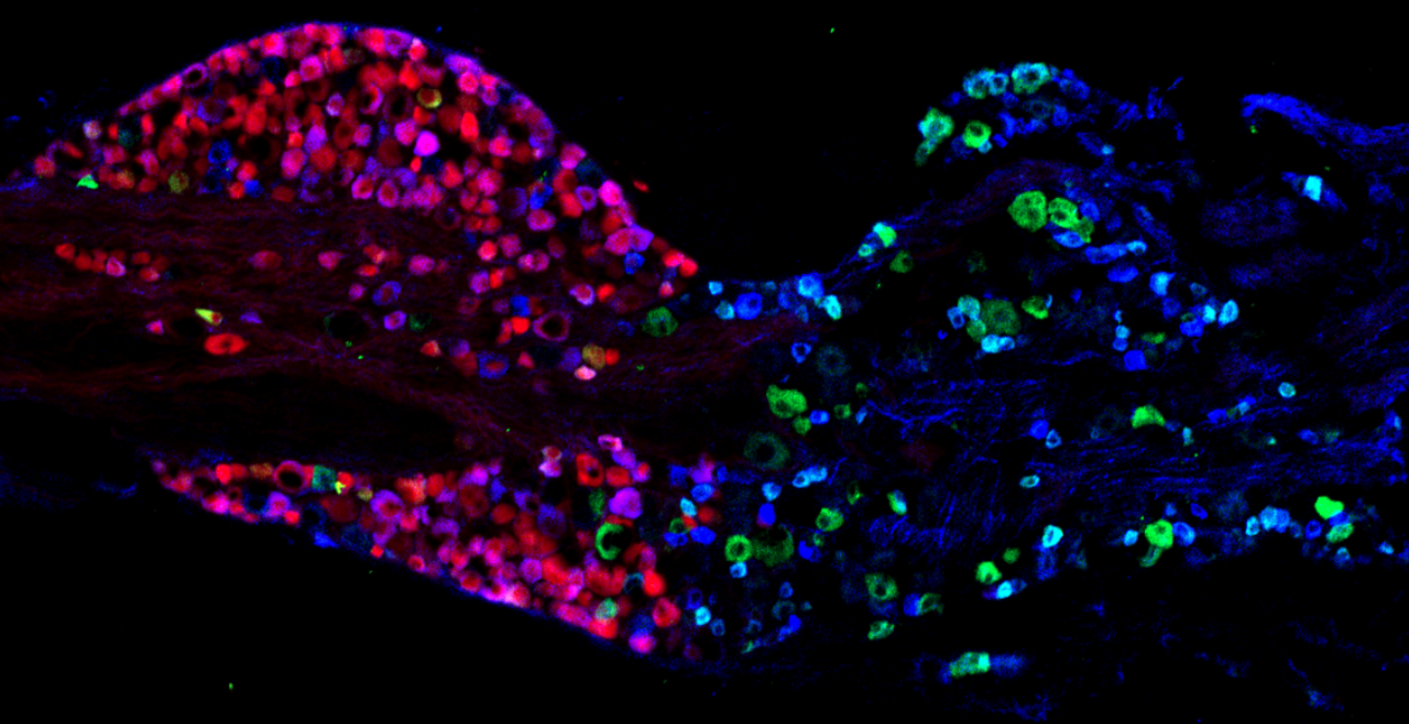 Vagal ganglia, with some neurons expressing P2X2 (red) in the nodose ganglion, and TrkA (green) in the jugular ganglion, and TRPV1 (blue) in both nodose and jugular ganglion