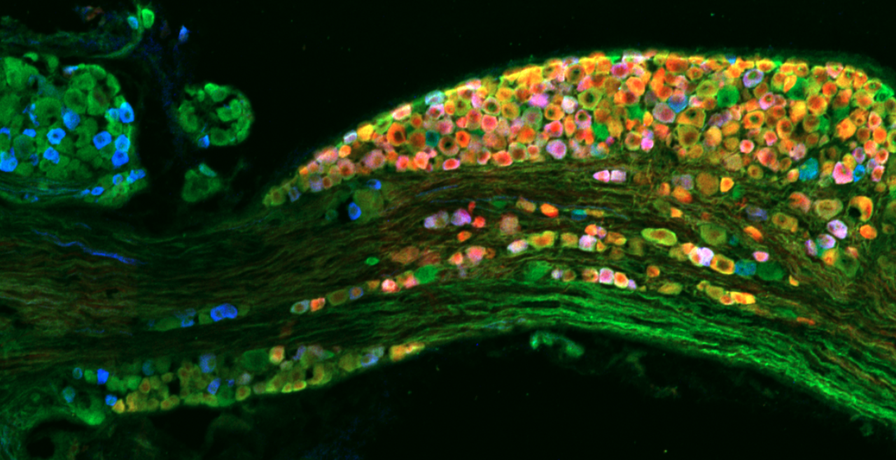 Vagal ganglia, with neurons labeled for P2X2 (red), pgp9.5 (green) and TRPV1 (blue)