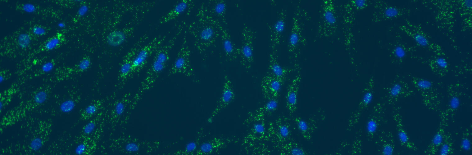 Exosomes 
