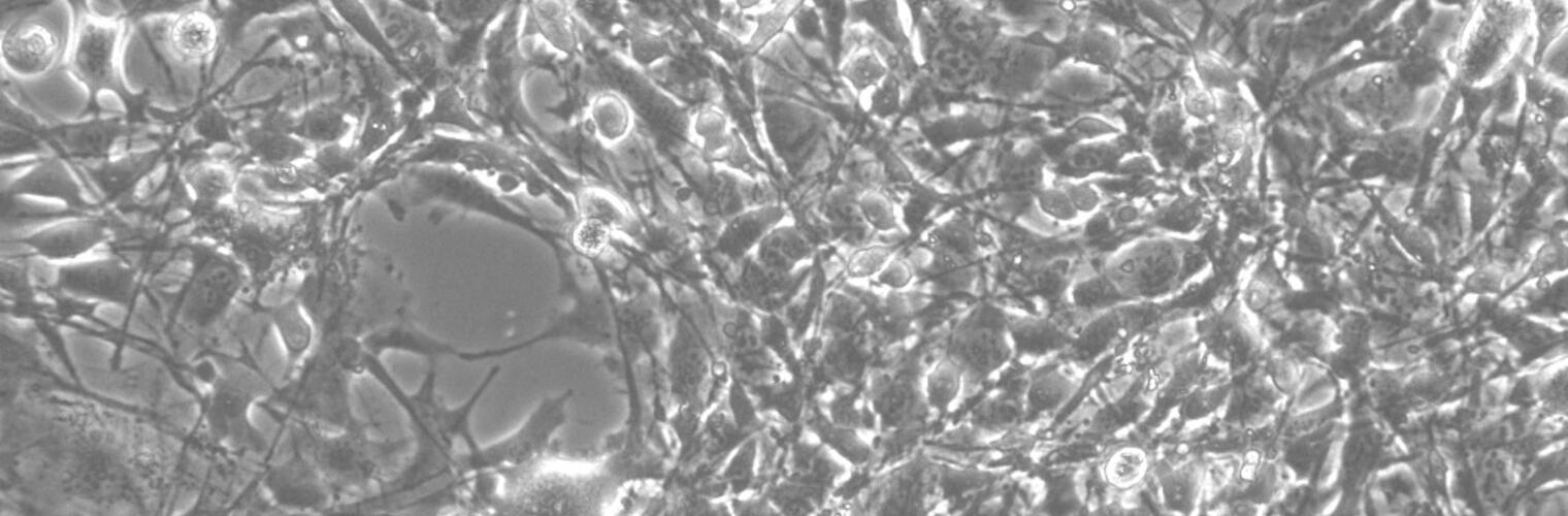 3T3 cells differentiated