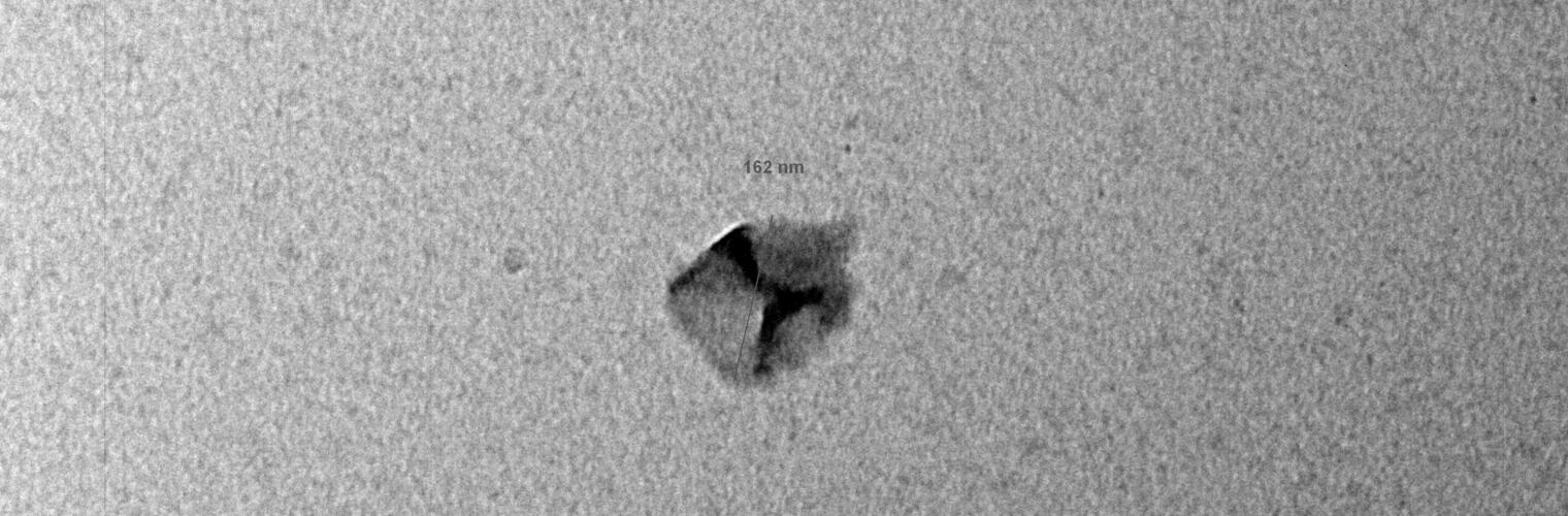 exosome TEM 