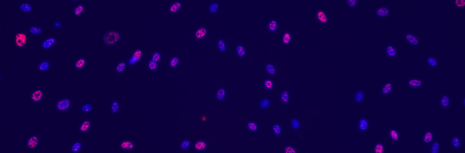 Exosomes 