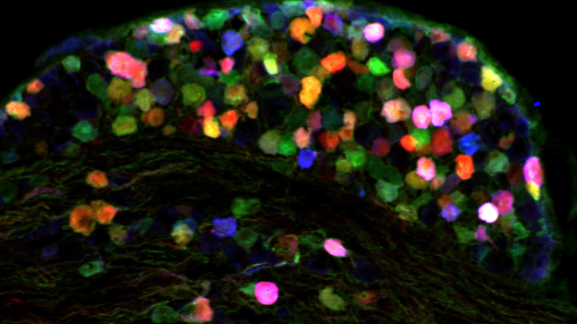 v1cre_brainbow_zoom