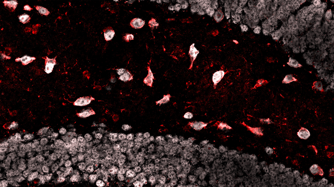Phosphorylated tau (red) in the hippocampus