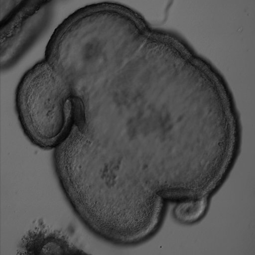 grayscale image of a cauliflower immature enteroid