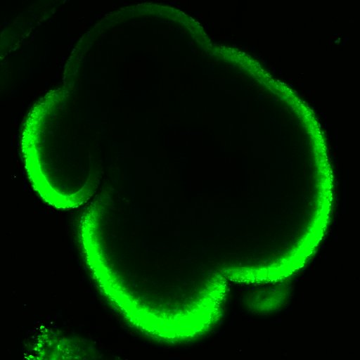 Fluorescent staining of a cauliflower immature enteroid