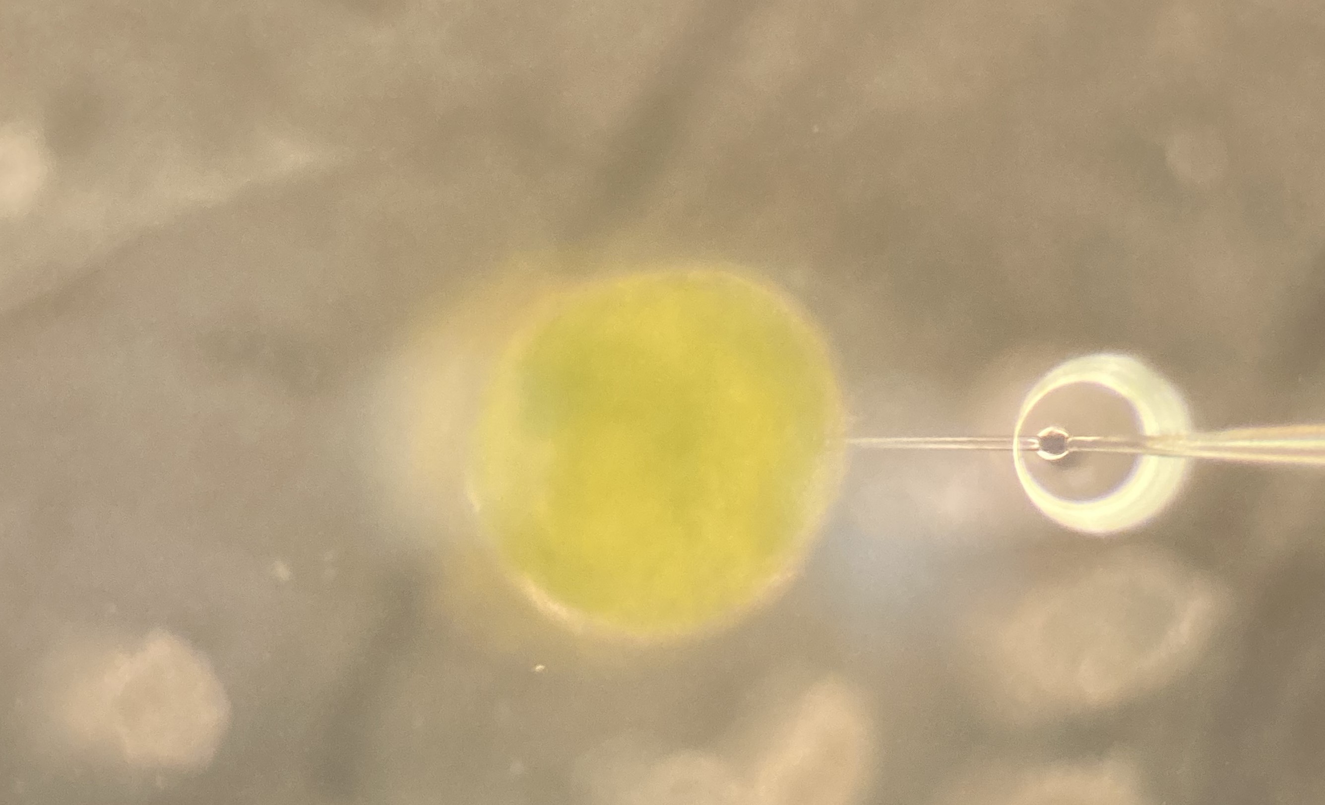 Fetal enteroid microinjected with a fluorescent molecule